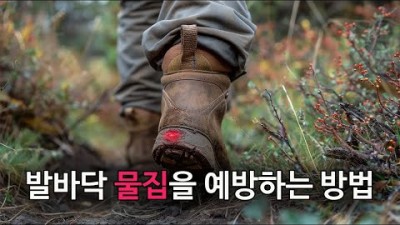 [박영준TV] 발바닥 물집을 예방하는 방법